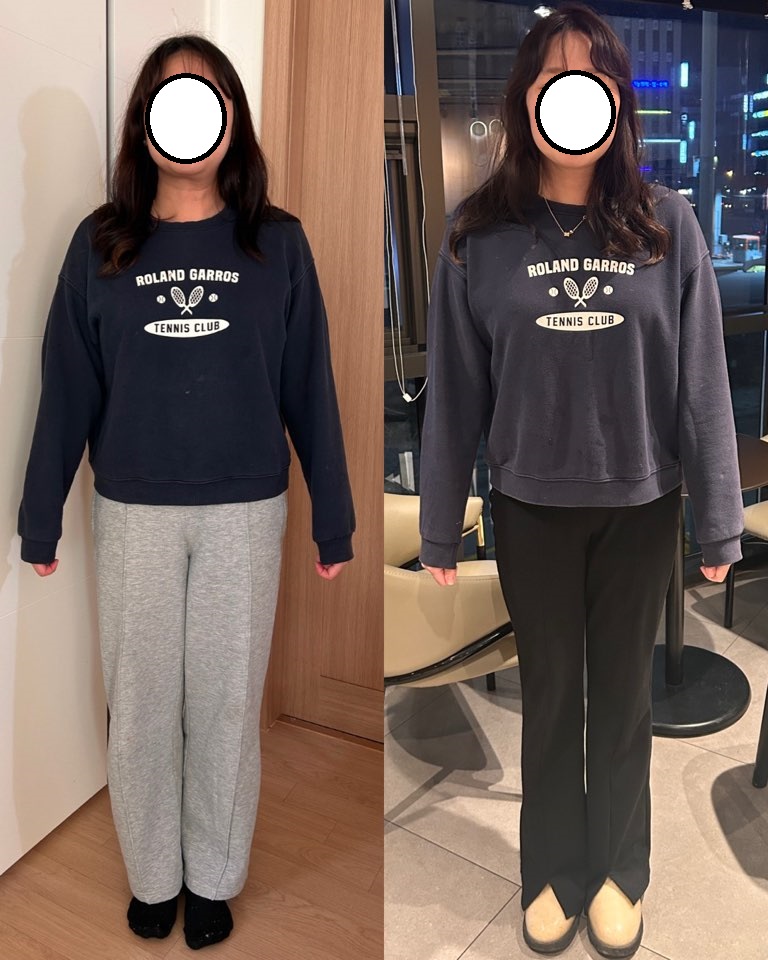 왼쪽 이미지